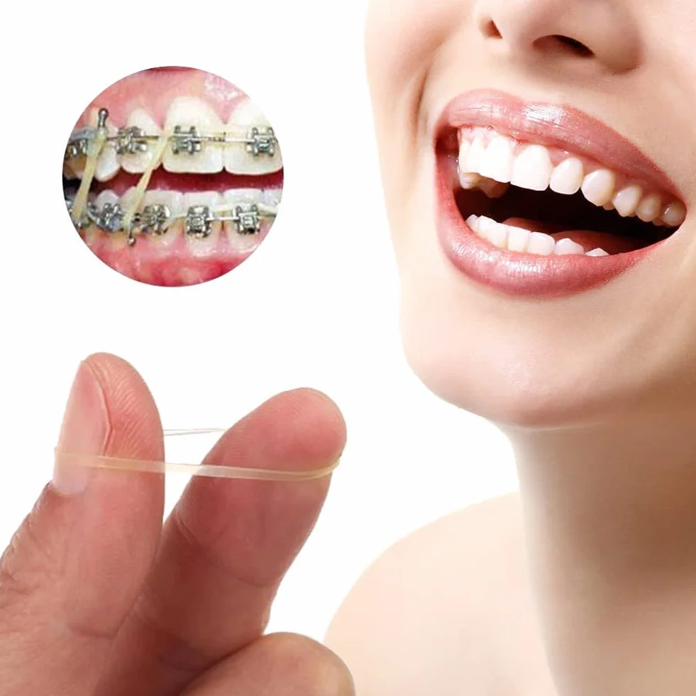 Ortodontyczne gumki gumowe 3/16 przezroczyste elastyczne taśmy 300 sztuk Orthodontics Rubber Band Tool