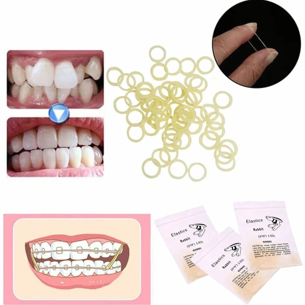 Ortodontyczne gumki gumowe 3/16 przezroczyste elastyczne taśmy 300 sztuk Orthodontics Rubber Band Tool